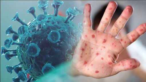 Ekvador'da maymun çiçeğinin yeni ve daha bulaşıcı bir varyantının ilk vakası tespit edildi